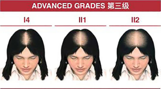 ӆ�ι���ϵ�y(t��ng)