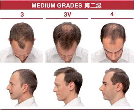 ӆ�ι���ϵ�y(t��ng)